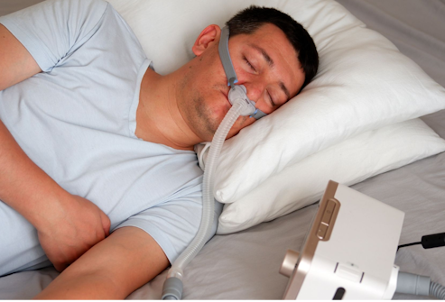 Sleep Apnea